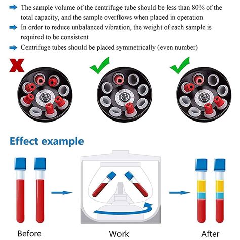 prp centrifuge speed and time